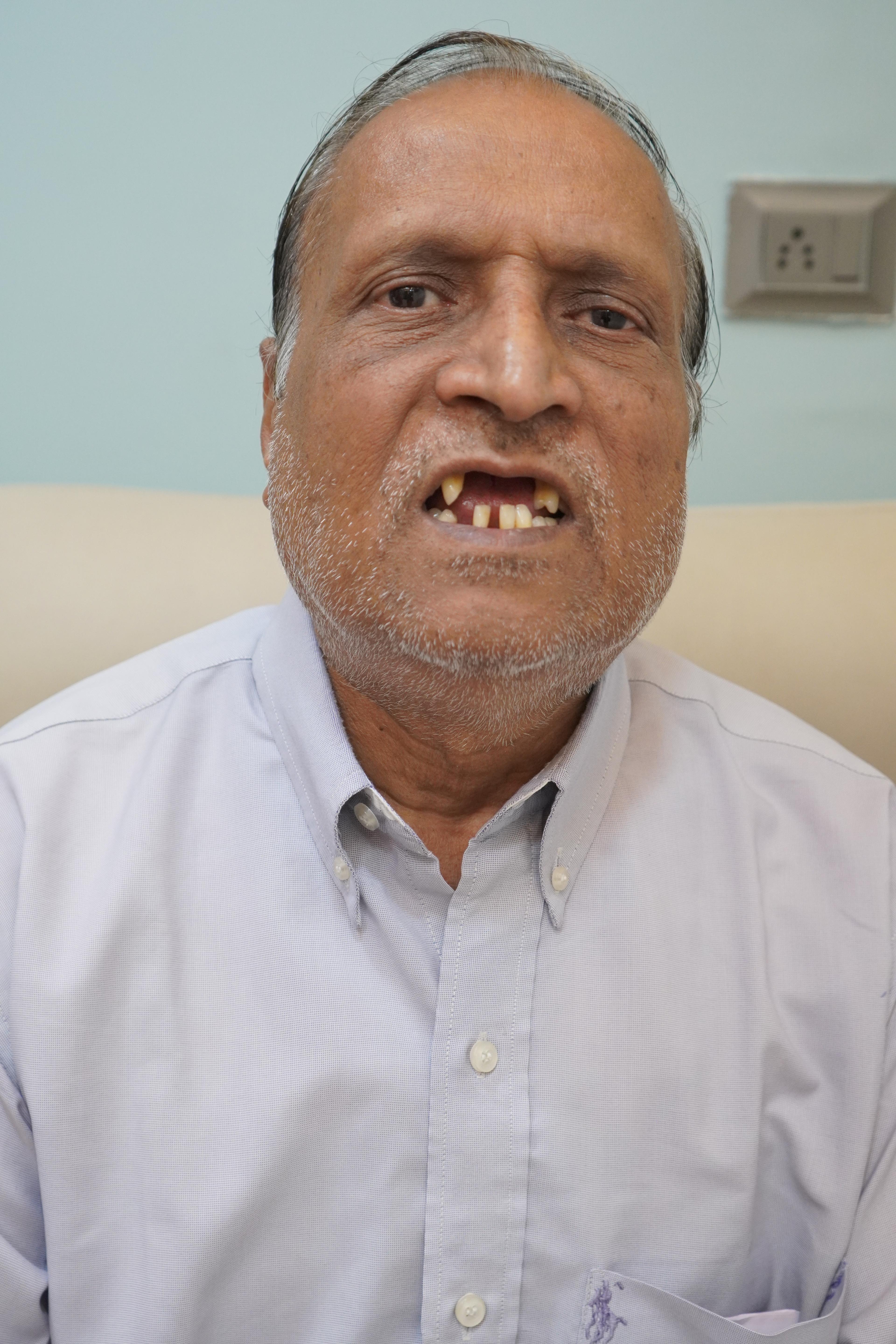 Madanlal Pardesi before treatment photo 2