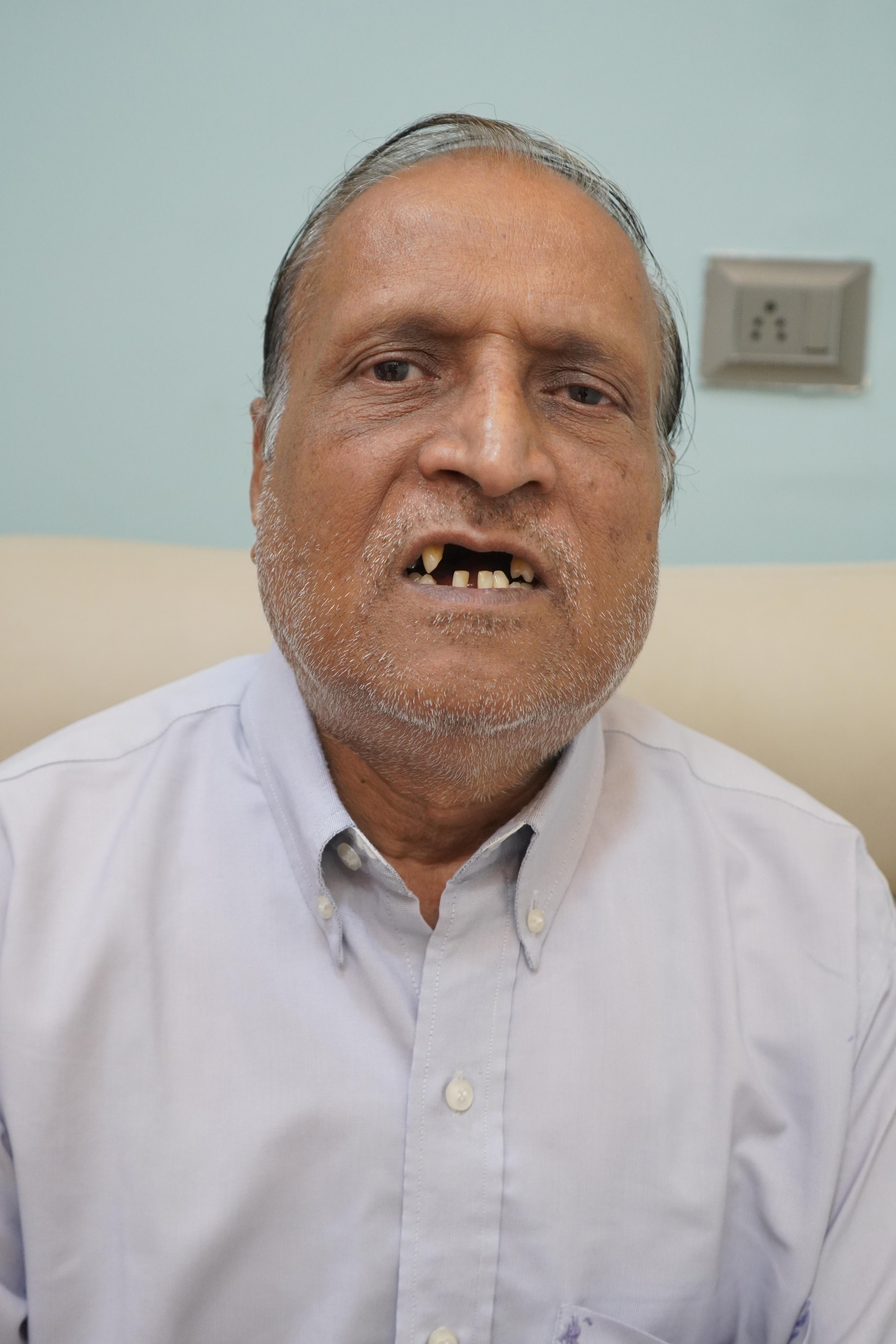 Madanlal Pardesi before treatment photo 3