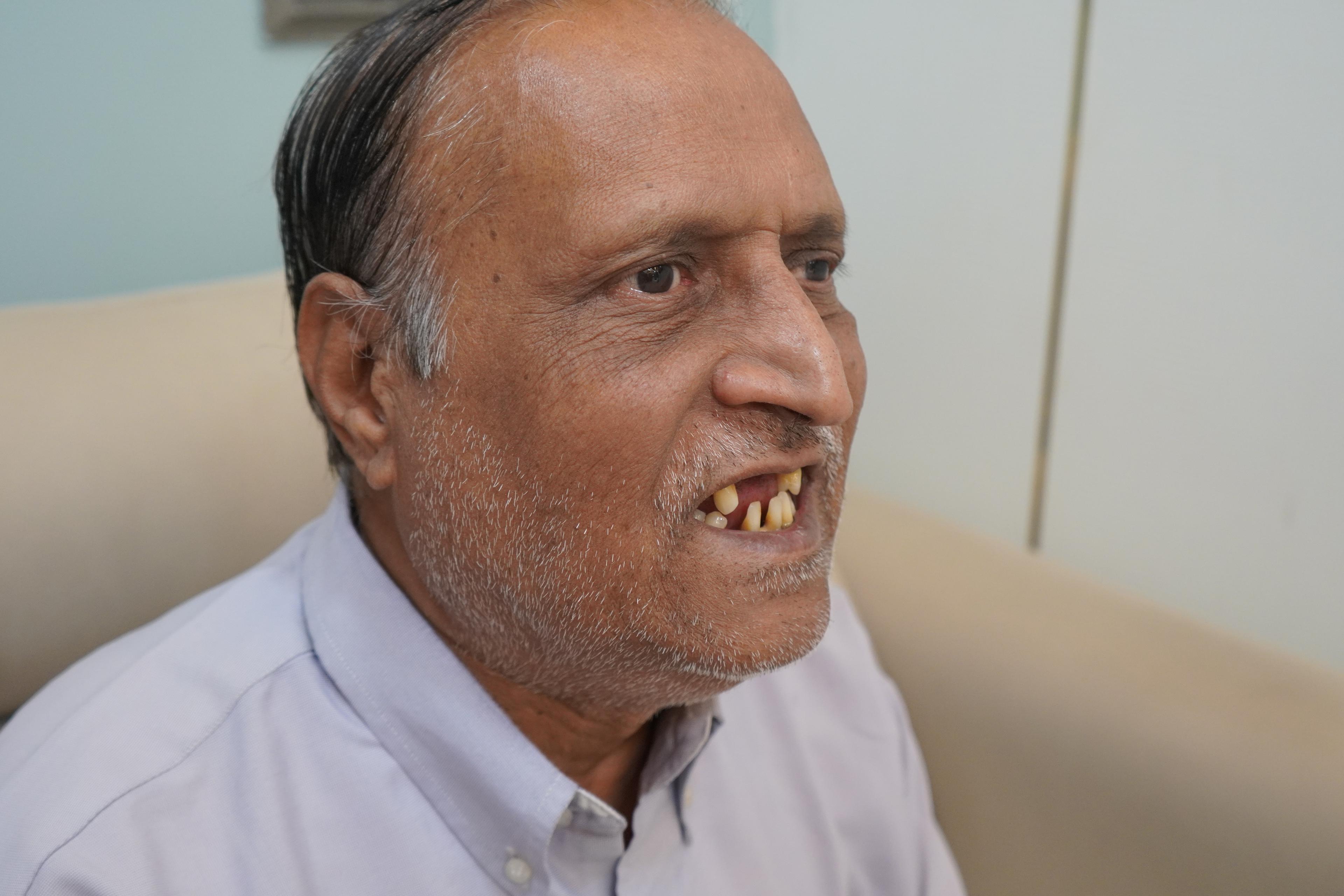 Madanlal Pardesi after treatment photo 1